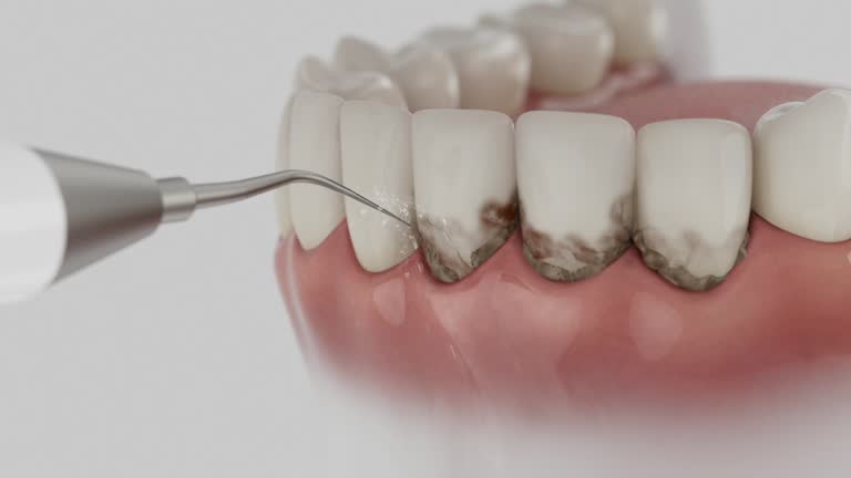 Trusted Invisalign Clear Aligners service in Atlantic City, NJ - Dentist Open Now